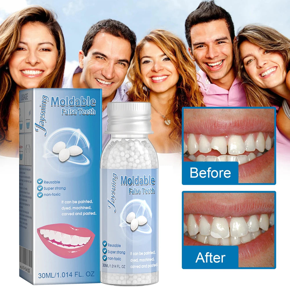 30g Temporary Tooth Repair Moldable Teeth And Gaps False Tooth Solid Gel Adhesive Fake Teeth Beauty Tool Dental Supplies