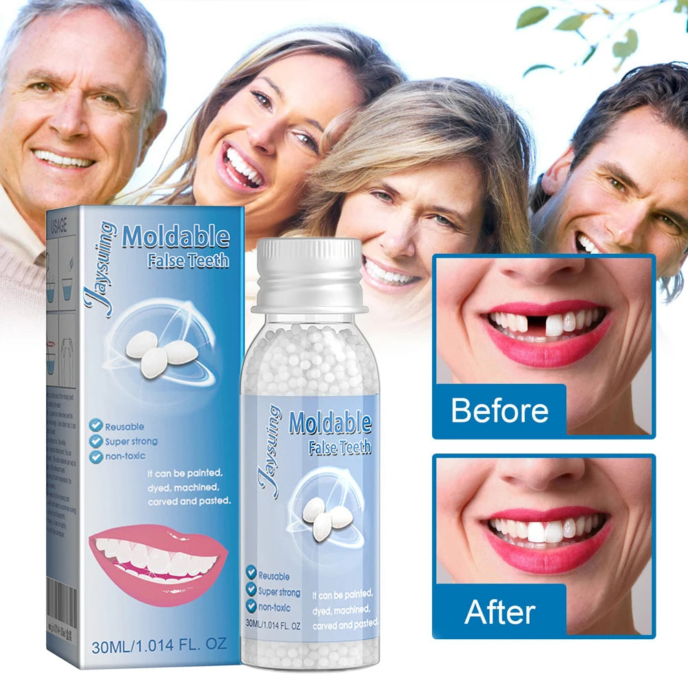 30g Temporary Tooth Repair Moldable Teeth And Gaps False Tooth Solid Gel Adhesive Fake Teeth Beauty Tool Dental Supplies