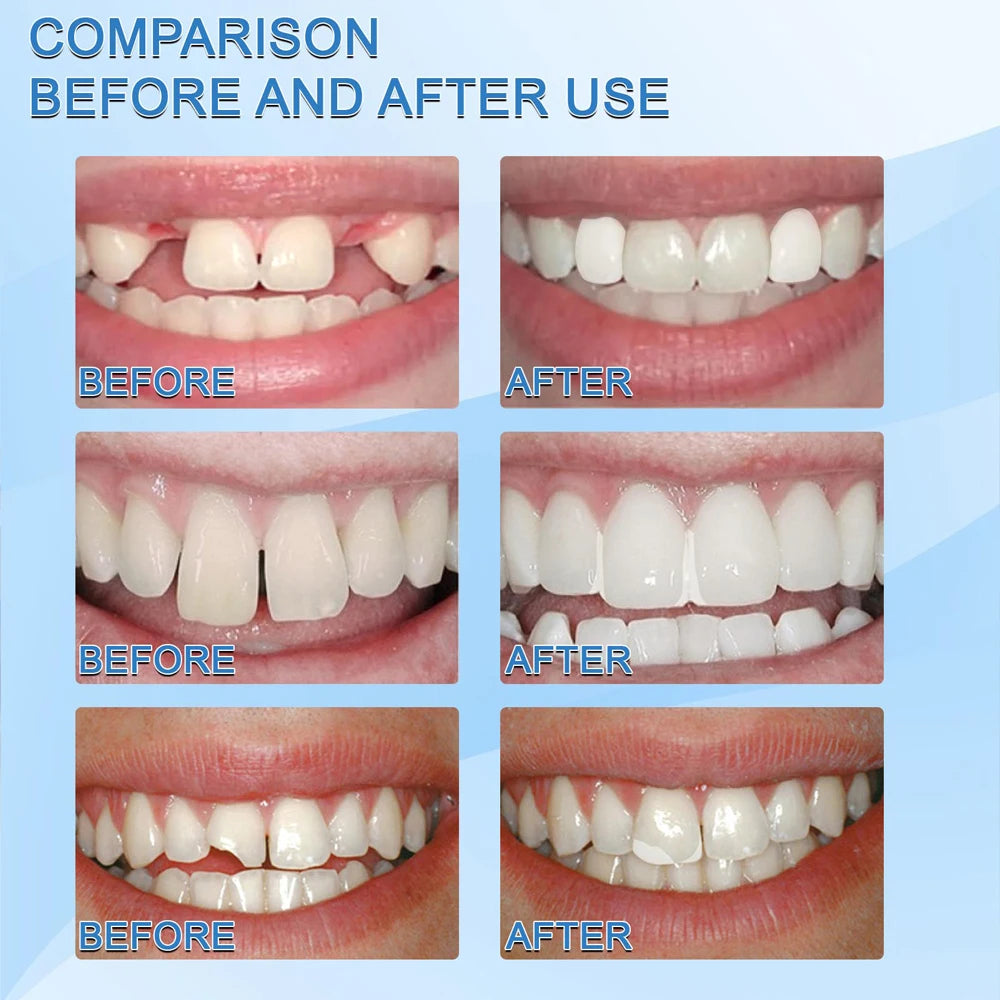 30g Temporary Tooth Repair Moldable Teeth And Gaps False Tooth Solid Gel Adhesive Fake Teeth Beauty Tool Dental Supplies