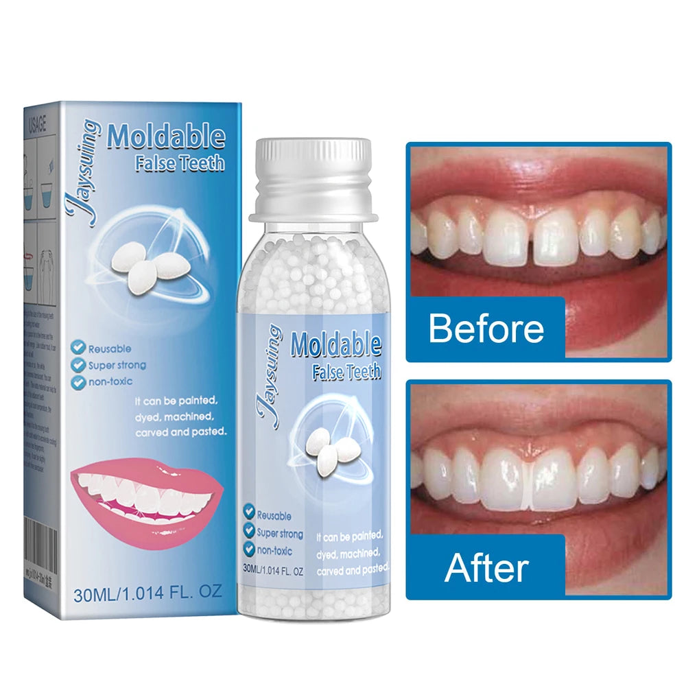 30g Temporary Tooth Repair Moldable Teeth And Gaps False Tooth Solid Gel Adhesive Fake Teeth Beauty Tool Dental Supplies
